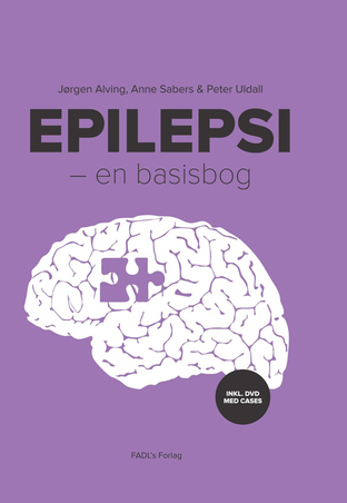 anm_epilepsi