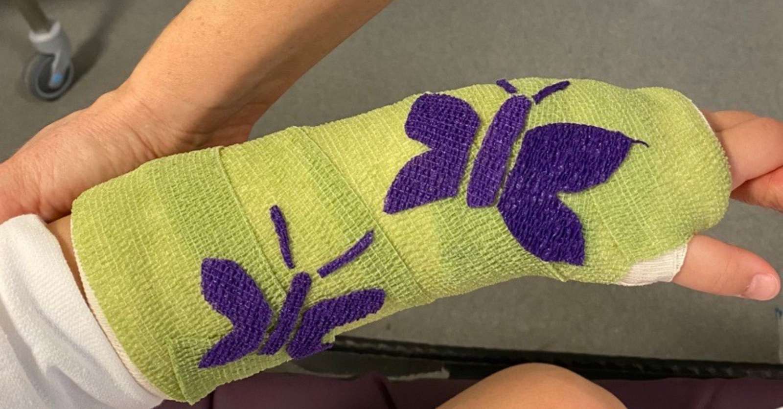 Gips 1