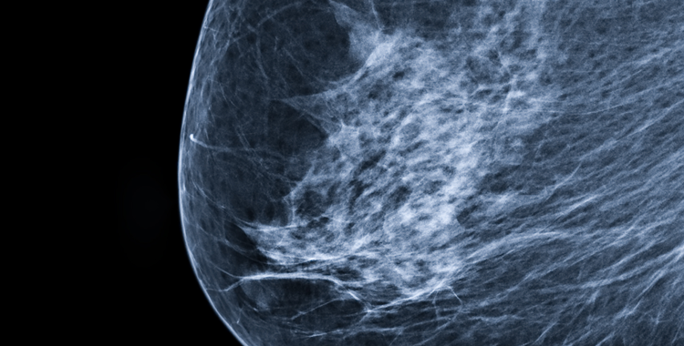 spl11-2019_tema_mammografi